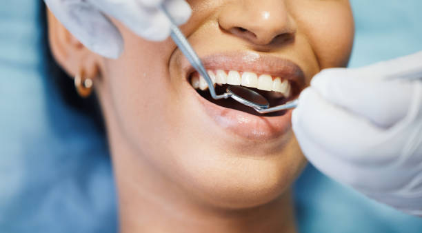 Best Emergency Root Canal Treatment in Cambria, IL