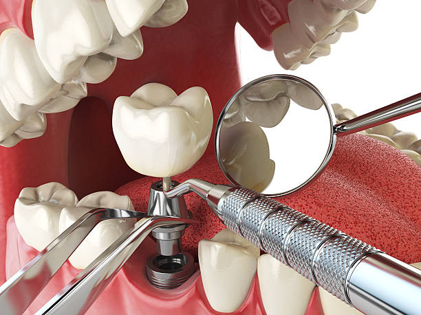 Best Emergency Dental Care for Trauma or Injury in Cambria, IL